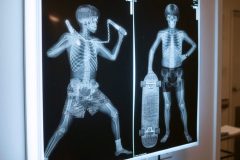 x-ray